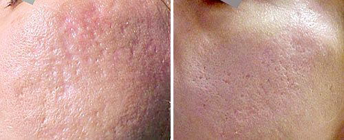 ベルビュー・プレミア・デンタル